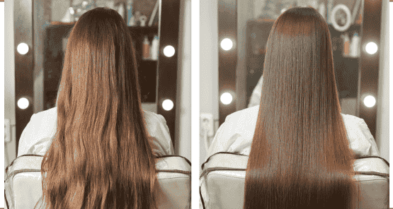 KorinMi Korean Anti-Hair Loss Program