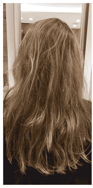 Before Treatment