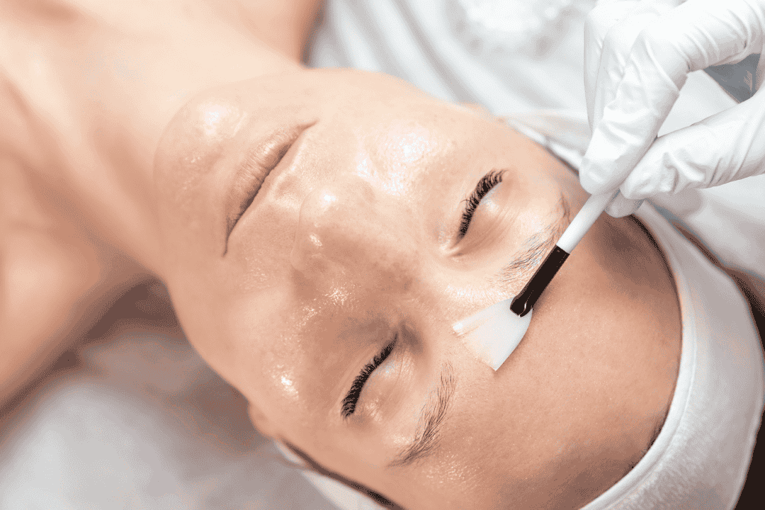 KorinMi Skin Resurfacing Treatment