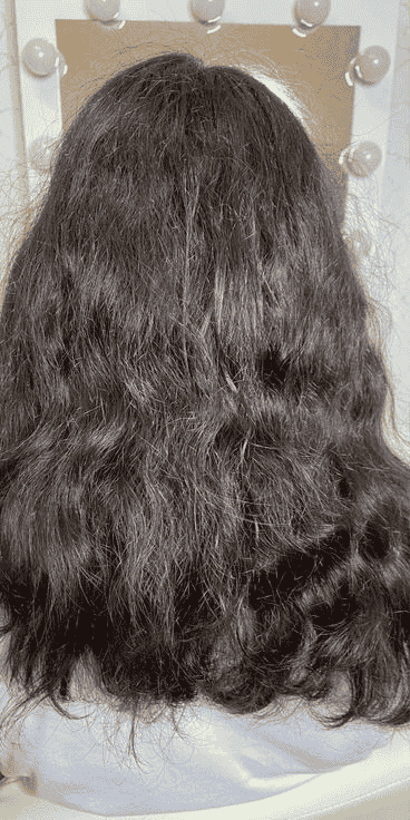 Before Treatment