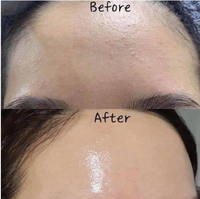 After Treatment