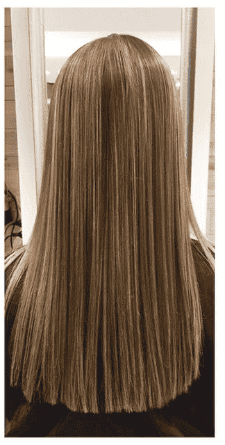 After Treatment
